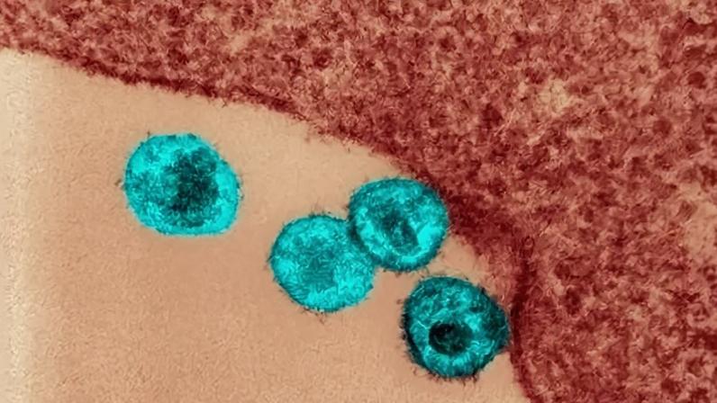Micrografia eletrônica de transmissão do HIV