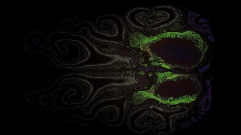 Fotografia microscópica de uma secção transversal do nariz de um rato geneticamente modificado para expressar proteína fluorescente verde nos neurônios olfativos — Foto: Datta Lab