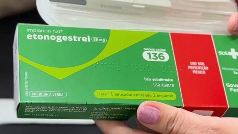 Implante contraceptivo etonogestrel, conhecido como Implanon. Medicamento é aplicado sob a pele
