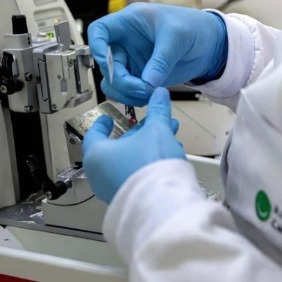 Lei amplia prevenção e controle do câncer no SUS