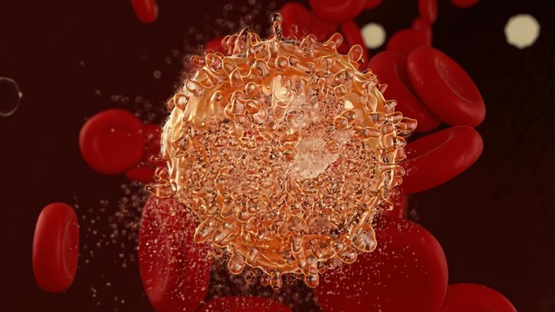 Leucemia mieloide aguda: uma das neoplasias hematológicas mais agressivas