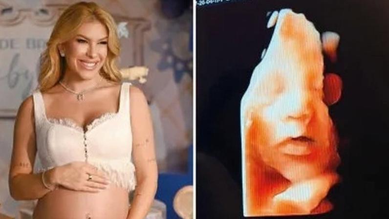 Lore Improta está grávida do 2º filho com Léo Santana