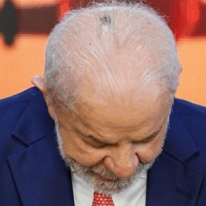 Lula faz procedimento médico em São Paulo e deve receber alta ainda hoje