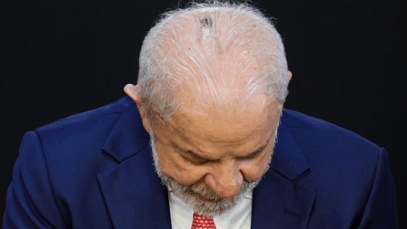 Em 9 de fevereiro, Lula já havia feito o tratamento para uma queratose actínica na cabeça