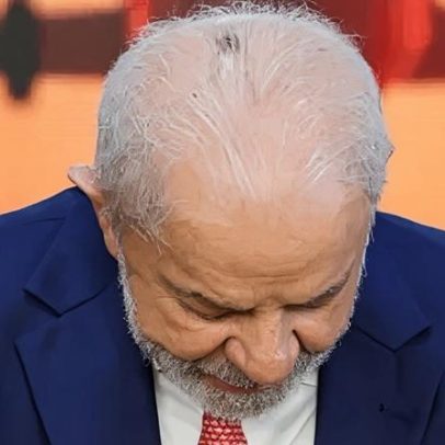 Histórico de idas ao hospital: cirurgia na cabeça e exames de rotina de Lula
