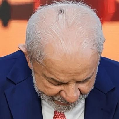 Lula viaja a SP para realizar dois procedimentos médicos nesta sexta