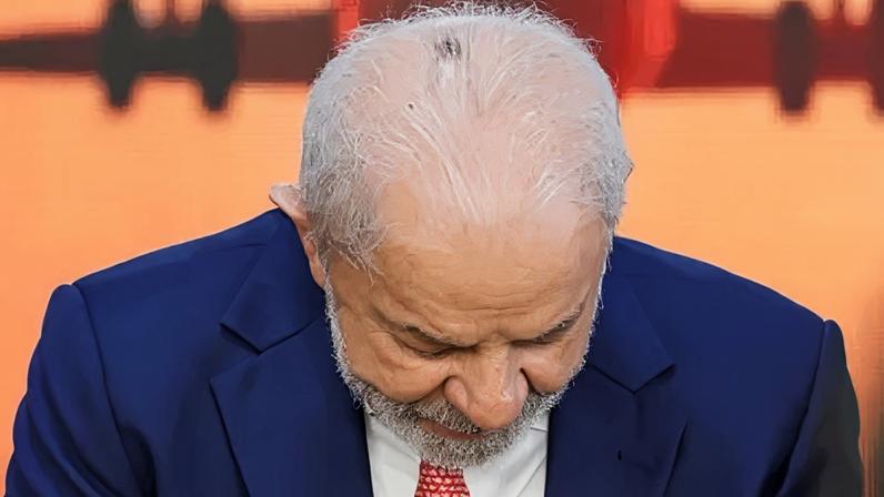 Lula aparece com marca na cabeça após procedimento para tratar queratose