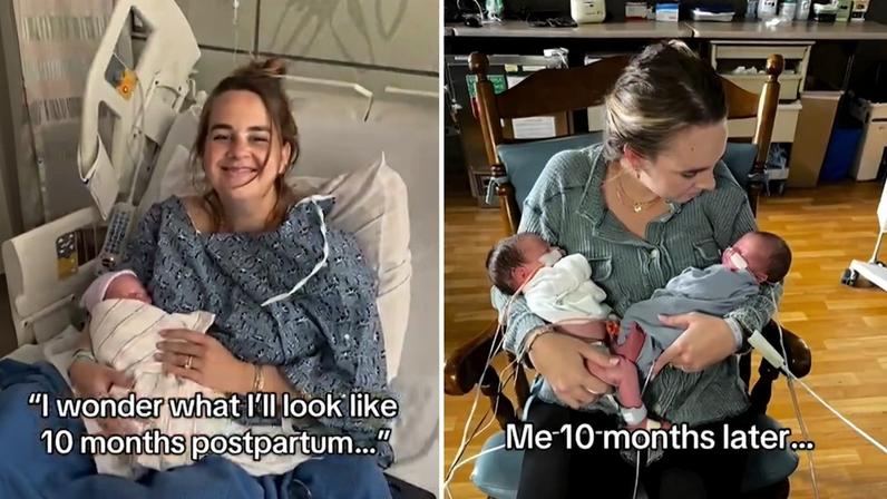 Mãe dá à luz gêmeos 10 meses após parto do segundo filho