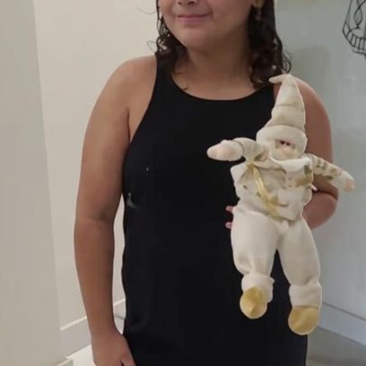 Menina com vitiligo questiona por que a mãe quer tratar as manchas