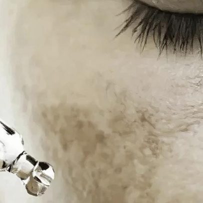 Dieta pode ajudar a prevenir e tratar manchas de melasma