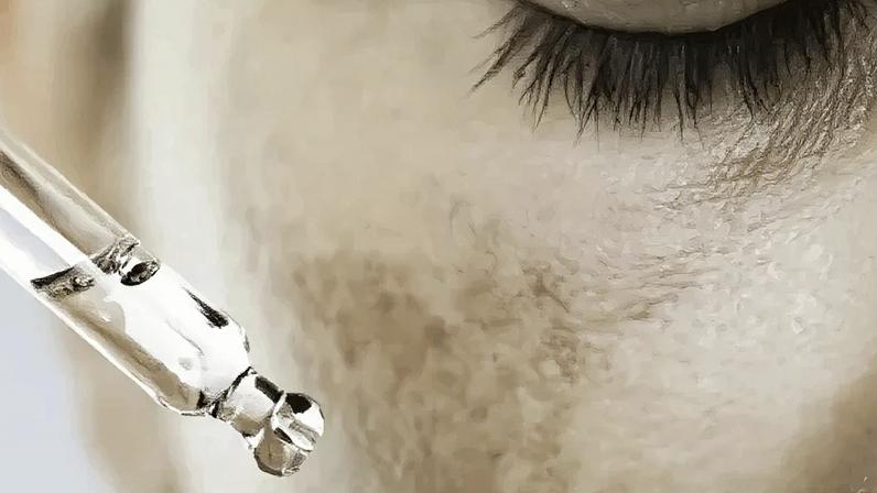 O melasma é mais frequente em mulheres, sobretudo em fases de variação hormonal
