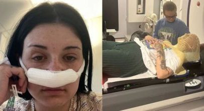 Mulher com sintomas tratados como estresse descobre tumor cerebral