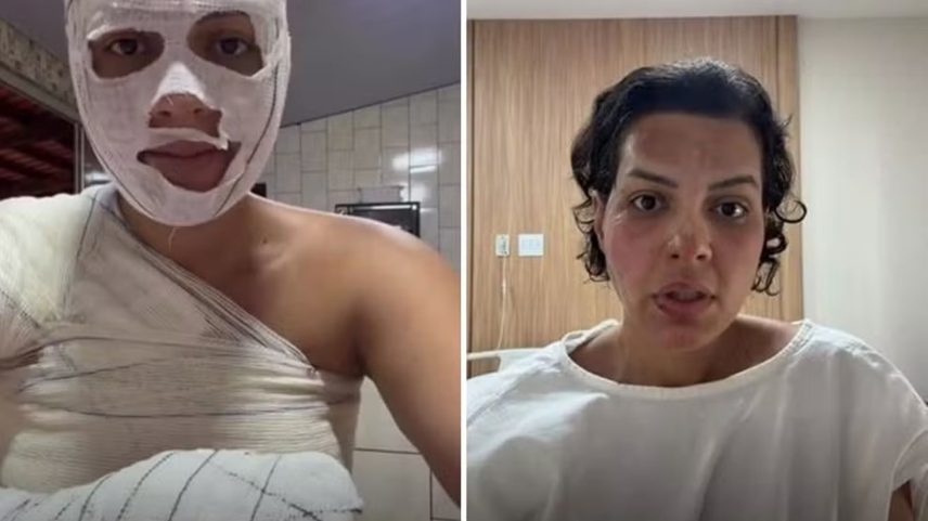 imagem colorida nutricionista queimaduras lixo