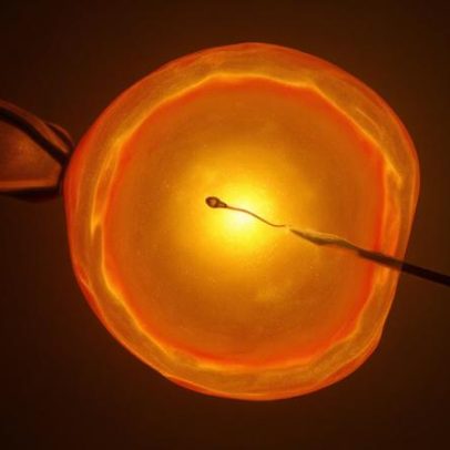 IA encontra espermatozoides ocultos, oferecendo esperança a inférteis