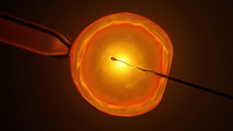 IA encontra espermatozoides ocultos, oferecendo esperança a inférteis