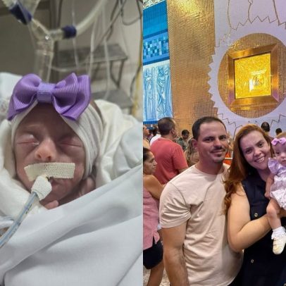 Bebê de 624 g vence 1% de chance e é batizado em Aparecida