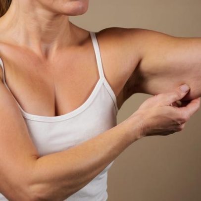 Conheça o melhor exercício para combater a flacidez dos braços
