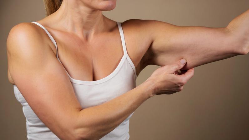 Adeus ao "tchauzinho": o melhor exercício para combater a flacidez