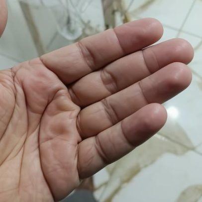 Criança de 2 anos é baleada durante ação da PM em BH