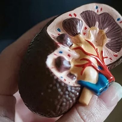 Doença renal crônica aparece mais cedo, alerta especialistas