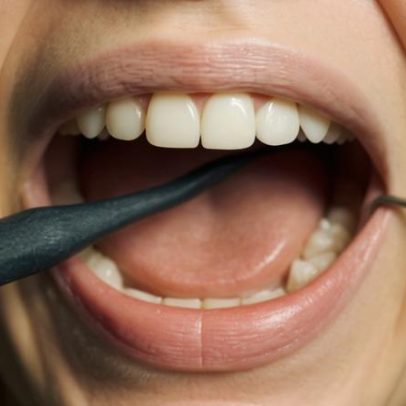 ONG realiza megatriagem para tratamento dentário gratuito
