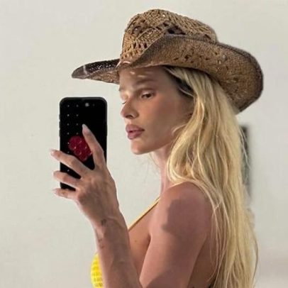 Yasmin Brunet revela antes e depois de tratamento para lipedema