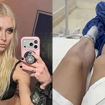 Taylor Momsen é picada por aranha venenosa após mordida de morcego