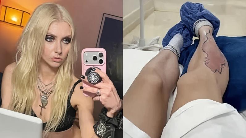 Taylor Momsen mostrou manchas na perna causadas por picada de inseto