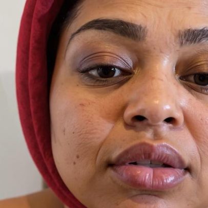 Ex-BBB Rízia Cerqueira relata acidente com moto elétrica e ferimentos
