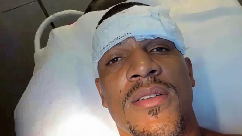 Atacante brasileiro deixa o campo desacordado após chute na cabeça