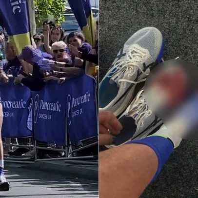 Atleta encerra maratona com lesão grave