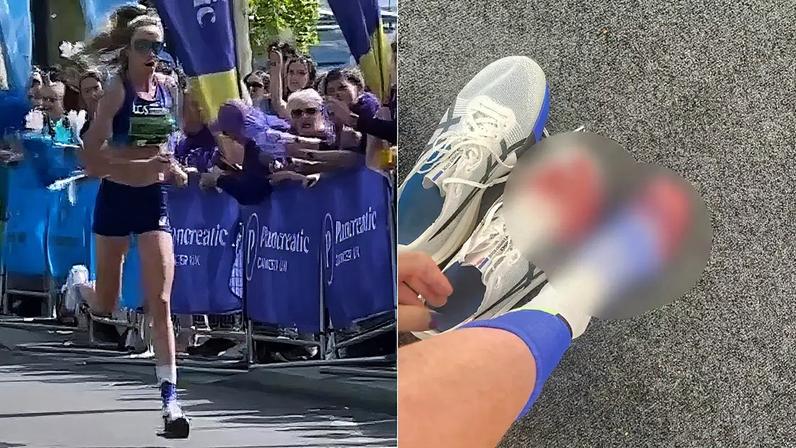 Atleta termina corrida com pés sangrando, em Londres