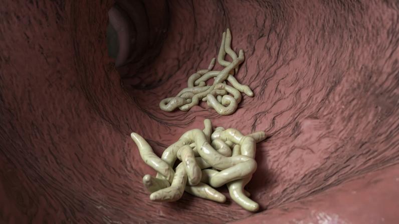 Ilustração colorida de vermes no intestino - Metrópoles