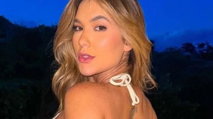 Virginia Fonseca lida com queda de cabelo causada por condição incomum