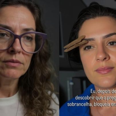 Médica avalia truque viral de pregador na sobrancelha contra enxaqueca