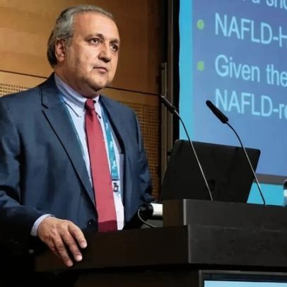 Especialista em gordura no fígado alerta: doença se tornou pandemia