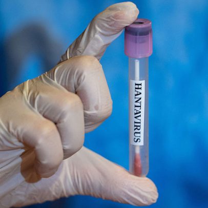 Brasil registra casos de hantavirose por ano, com monitoramento em curso