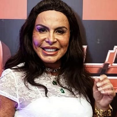 Gretchen comenta alopecia progressiva e impacto na autoestima