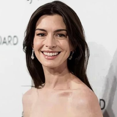 Anne Hathaway comenta rumores sobre procedimentos estéticos no rosto