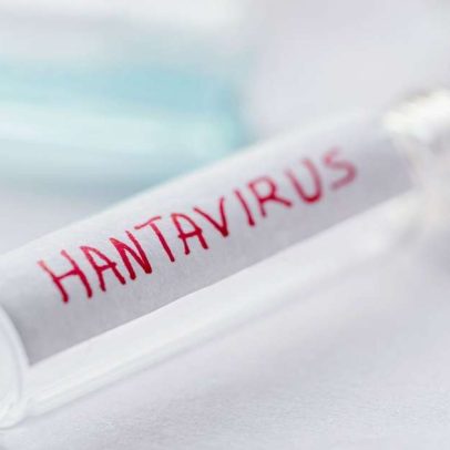 OMS esclarece riscos do hantavírus para a população global