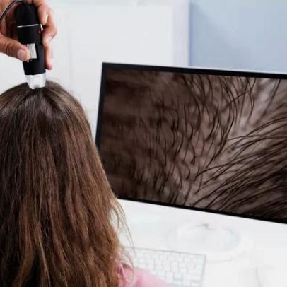 Tratamentos capilares ganham novas tecnologias