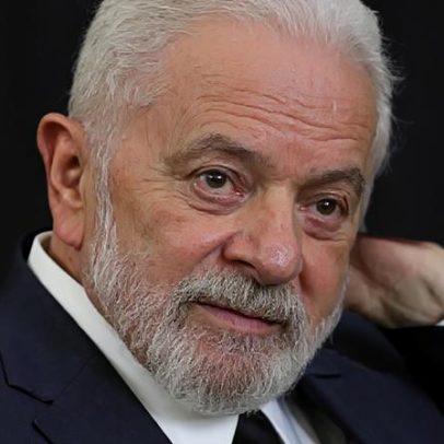 Lula inicia radioterapia após cirurgia de câncer de pele