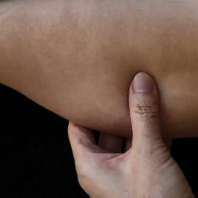 Treino com 4 exercícios ajuda a reduzir a flacidez da parte interna do braço