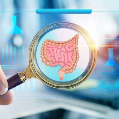 SUS adota novo exame que detecta câncer de intestino antes dos sintomas
