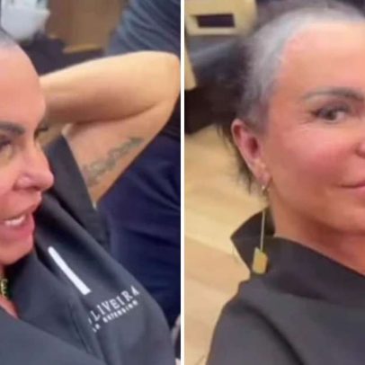 Especialista alerta sobre riscos do procedimento capilar feito em Gretchen