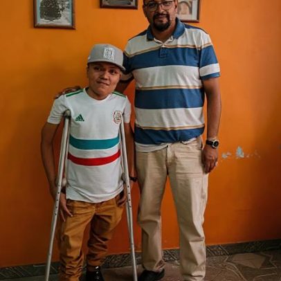 Jovem com doença rara supera depressão e encontra esperança no México