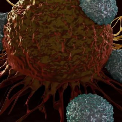 Cientistas filmam defesa imune abrindo buracos em tumores para combater o câncer
