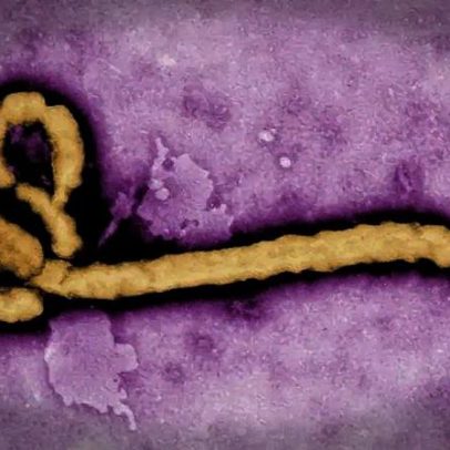 Risco de surto de Ebola chegar ao Brasil é avaliado por autoridades