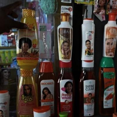 Razões por trás do clareamento de pele entre mulheres africanas