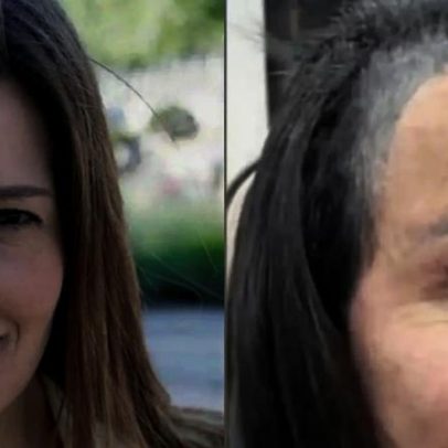 Dermatologista aponta azeite de oliva como auxílio no crescimento capilar